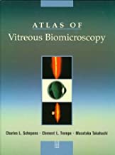 ATLAS OF VITERIOUS BIOMICROSCOPY