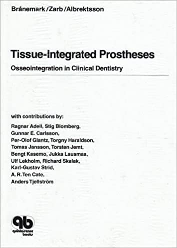 TISSUE-INTEGRATED PROSTHESES: OSSEOINTEGRATION IN CLINICAL DENTISTRY ILLUSTRATED EDITION