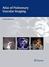 ATLAS OF PULMONARY VASCULAR IMAGING