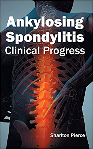 ANKYLOSING SPONDYLITIS: CLINICAL PROGRESS