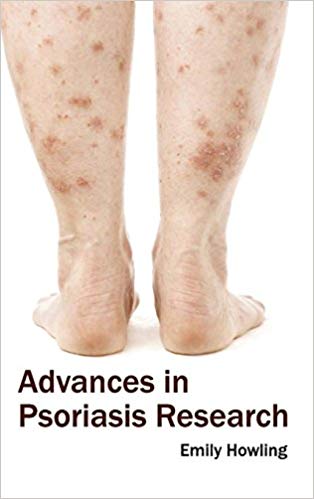 ADVANCES IN PSORIASIS RESEARCH : 1/E 2015