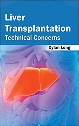 LIVER TRANSPLANTATION: TECHNICAL CONCERNS; 1/E 2015