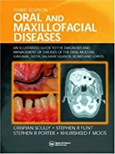 ORAL AND MAXILLOFACIAL DISEASES