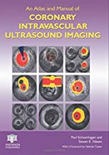 AN ATLAS OF MANUAL OF CORONARY INTRAVASCULAR ULTRASOUND IMAGING