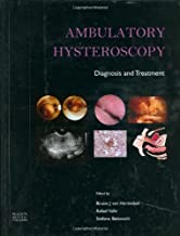 AMBULATORY HYSTEROSCOPY