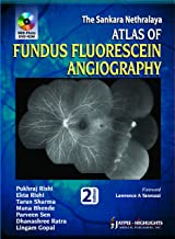THE SANKARA NETHRALAYA ATLAS OF FUNDUS FLUORESCEIN ANGIOGRAPHY WITH PHOTO DVD-ROM 2/E 2013
