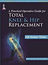 A PRACTICAL OPERATIVE GUIDE FOR TOTAL KNEE AND HIP REPLACEMENT 2/E 2015