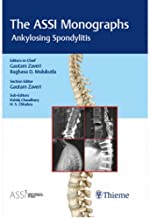 ANKYLOSING SPONDYLITIS